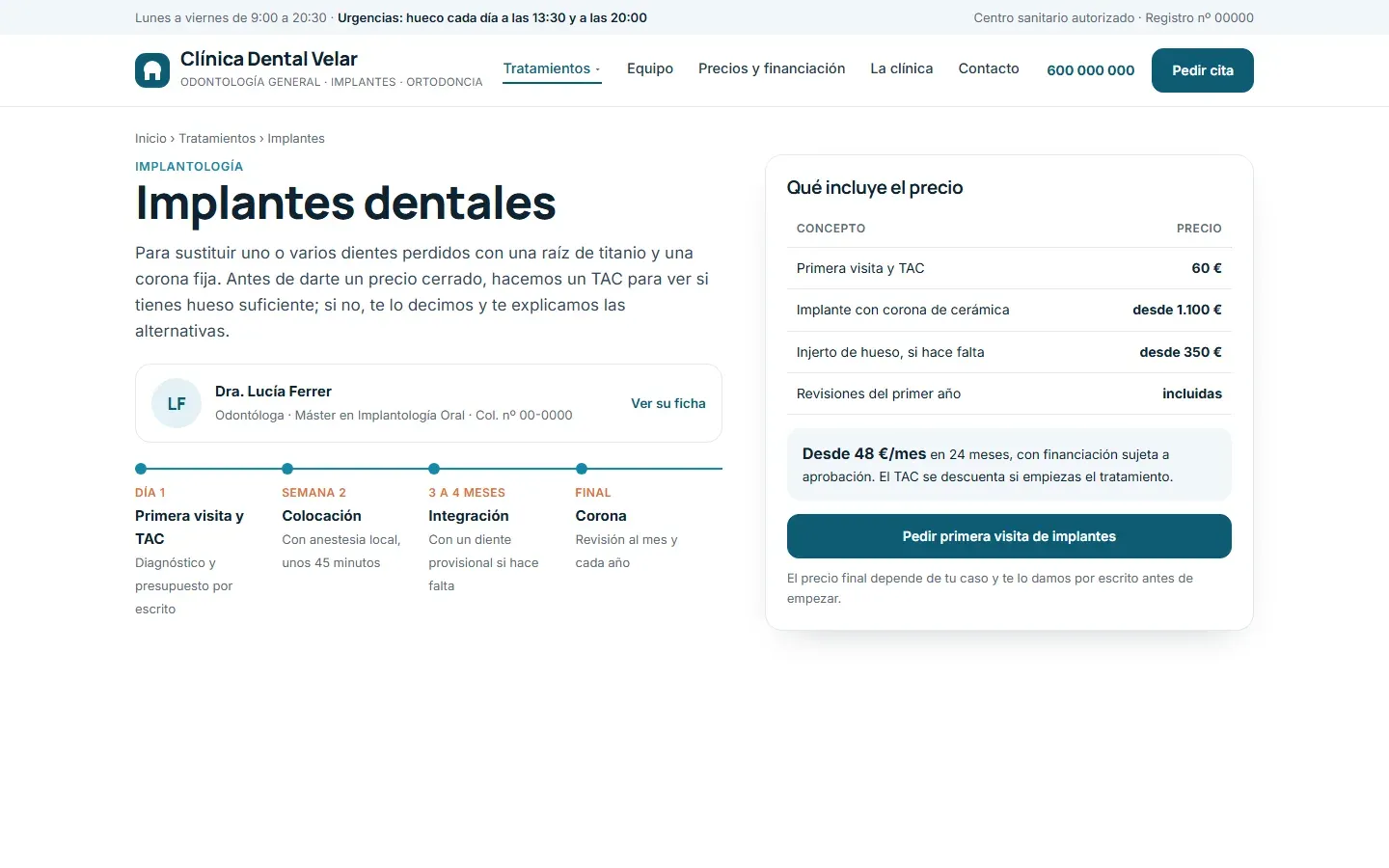 Página de implantes con la doctora que los hace y su número de colegiado, los cuatro pasos del tratamiento y una tabla de qué incluye el precio con la financiación