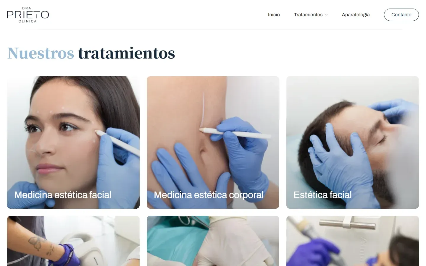 Tratamientos de la Clínica Dra. Prieto ordenados por zona: medicina estética facial, corporal y estética facial